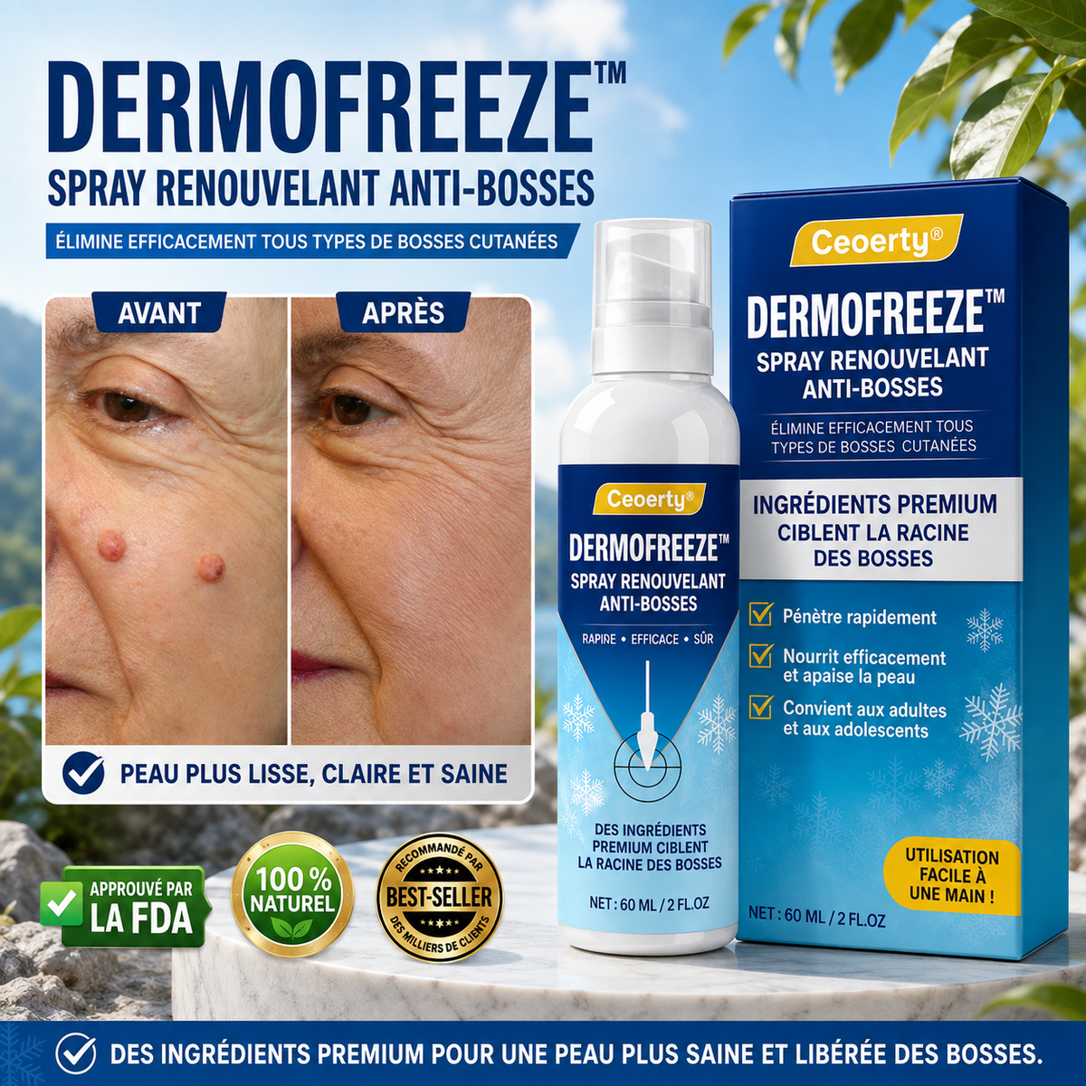 DermoFreeze™ Spray Cryo Anti-Imperfections | Supprime verrues, bosses et rugosités visibles dès les premières applications !
