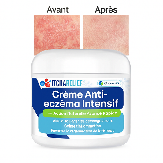 DermaRelief™ Crème Anti-Eczéma Intensif | Stoppe démangeaisons et rougeurs en 5 minutes!