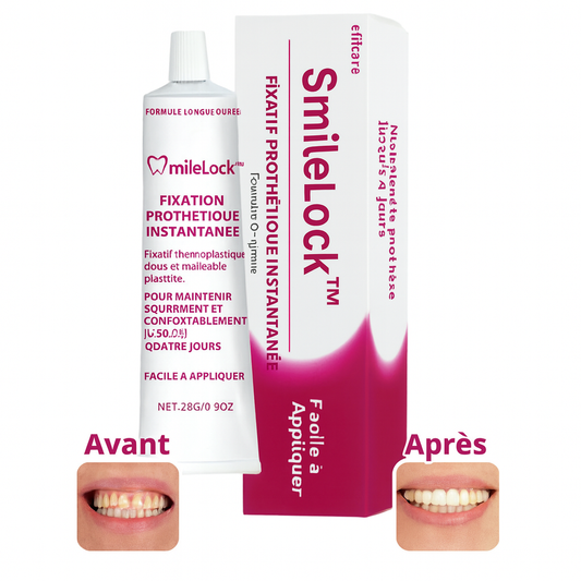 SmileLock™ Fixation Prothétique Instantanée | Maintient votre prothèse 24 h, sans colle ni gêne!