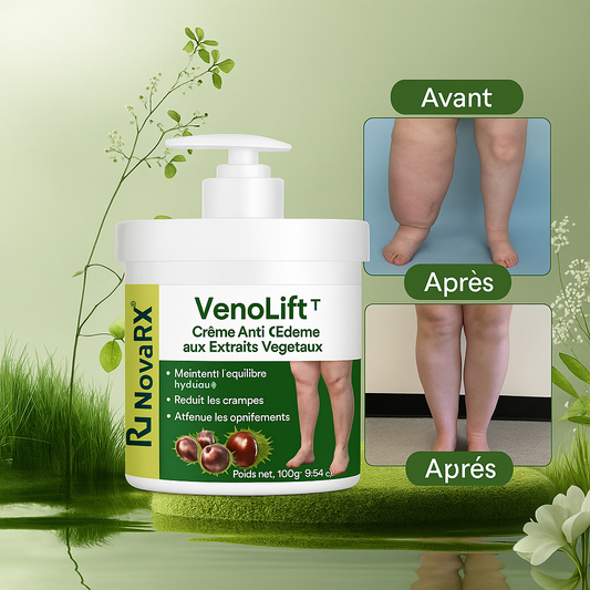 VenoLift™ Crème Anti-Œdème aux Extraits Végétaux | Décongestionne vos jambes lourdes en 5 minutes!