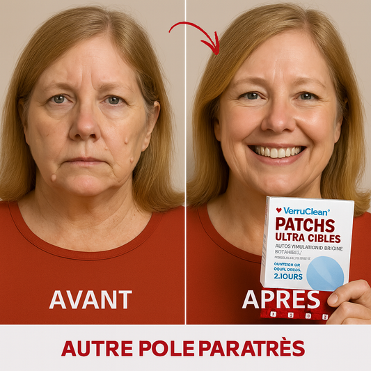 VerruClean™ Patchs Ultra-Ciblés | Détruit verrues & excroissances en 48h sans douleur!