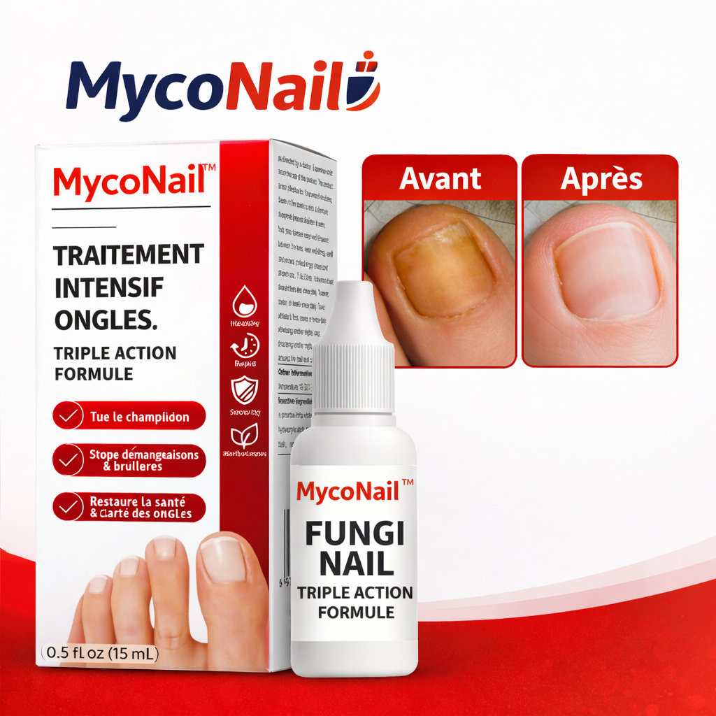 MycoNail™ Traitement Intensif Ongles | Éliminez jusqu’à 98 % des mycoses en 7 jours chrono !