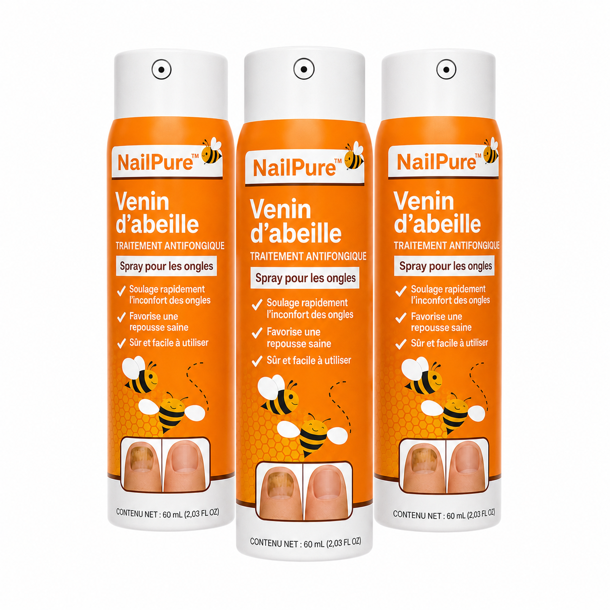 NailPure™ Spray antifongique | Éliminez 99 % des mycoses des ongles en seulement 3 jours !