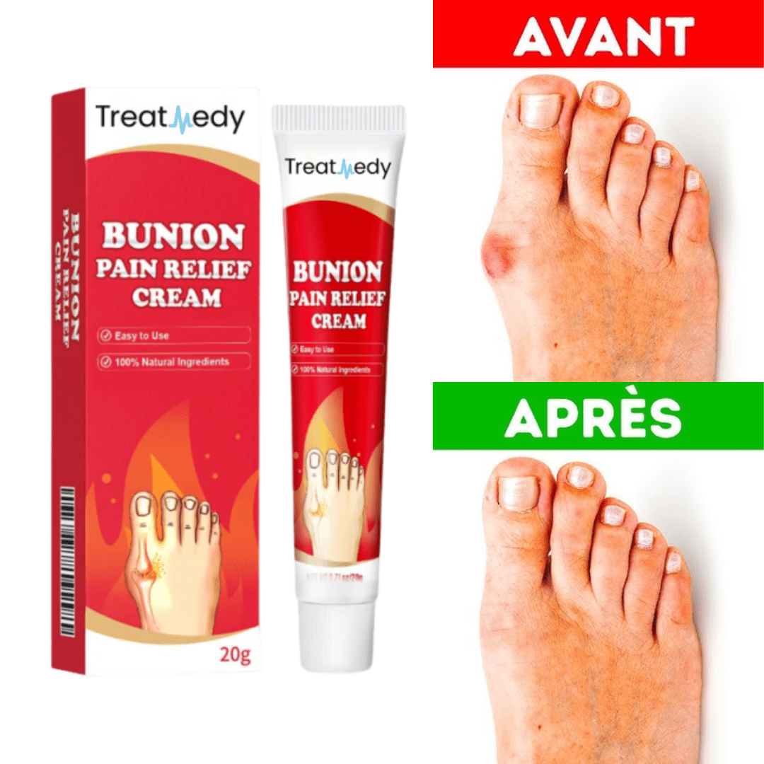 TreatMedy™ Crème Anti-Douleur Révolutionnaire | Dites adieu aux hallux valgus en seulement 10 minutes !