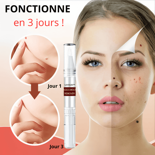 Lovilds™ Stylo anti-imperfections | Efface les verrues et les imperfections en 2 minutes!
