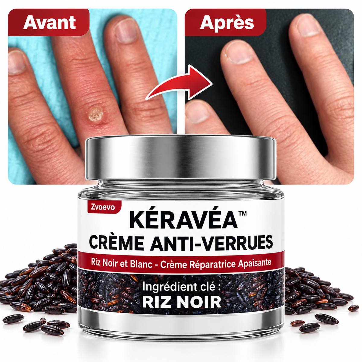 Kéravéa™ Crème Anti-Verrues | Élimine verrues, tumeurs cutanées et taches noires dès la 1ʳᵉ application – sans chirurgie, sans cicatrice!