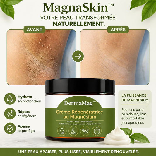 MagnaSkin™ Crème Renouvellement au Magnésium | Répare la peau, efface imperfections et apaise les plaques en 7 minutes !