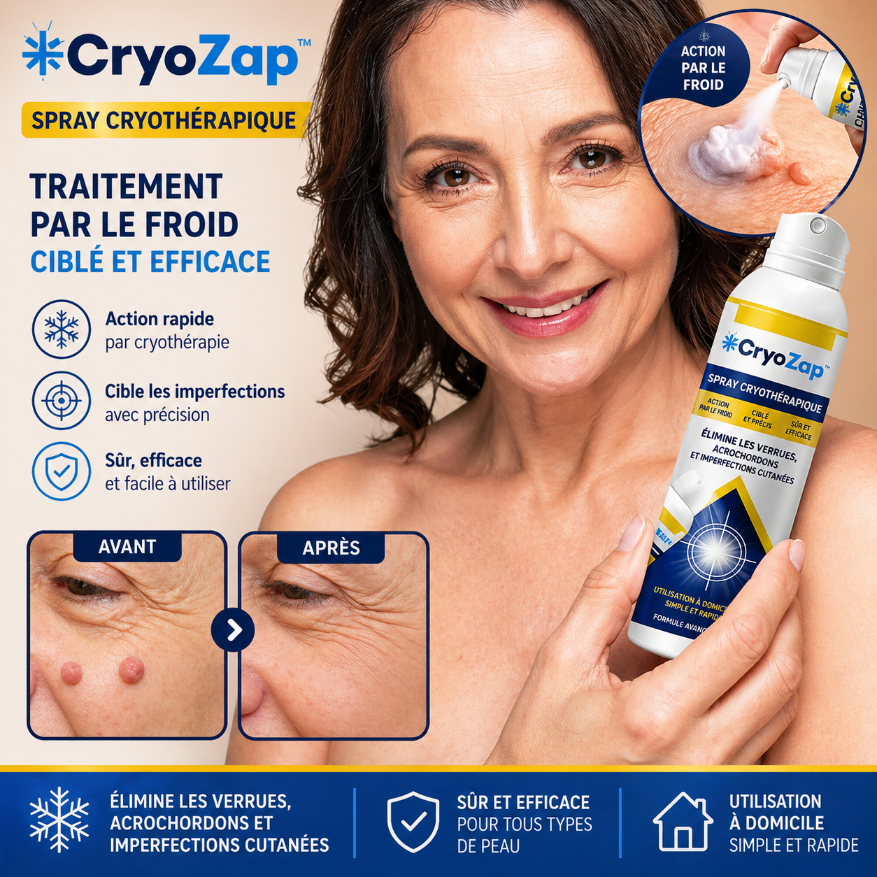 CryoZap™ Spray Cryothérapique | Éradiquez 98% de vos verrues et acrochordons en seulement 7 jours !