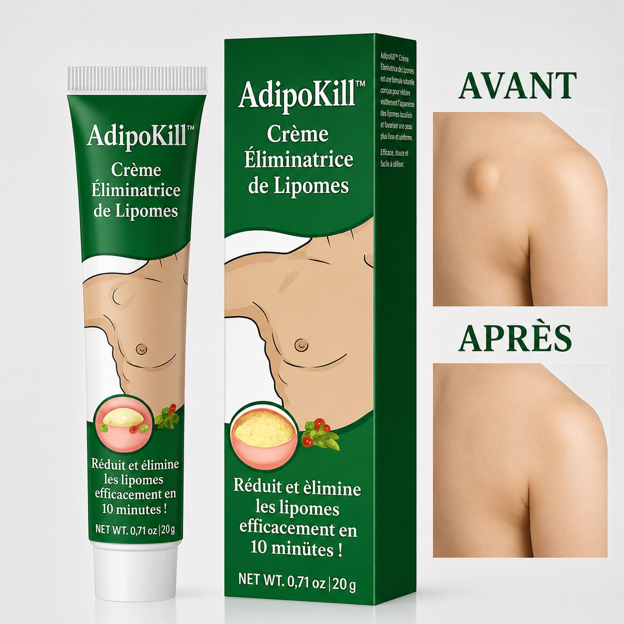 AdipoKill™ Crème Éliminatrice de Lipomes | Réduit et élimine les lipomes efficacement en 10 minutes!