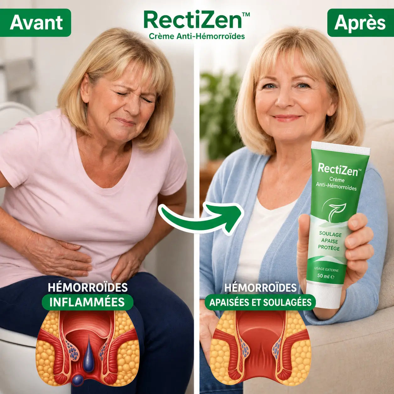 RectiZen™ Crème Anti-Hémorroïdes | Soulage 99 % de la douleur liée aux hémorroïdes dès la première application !
