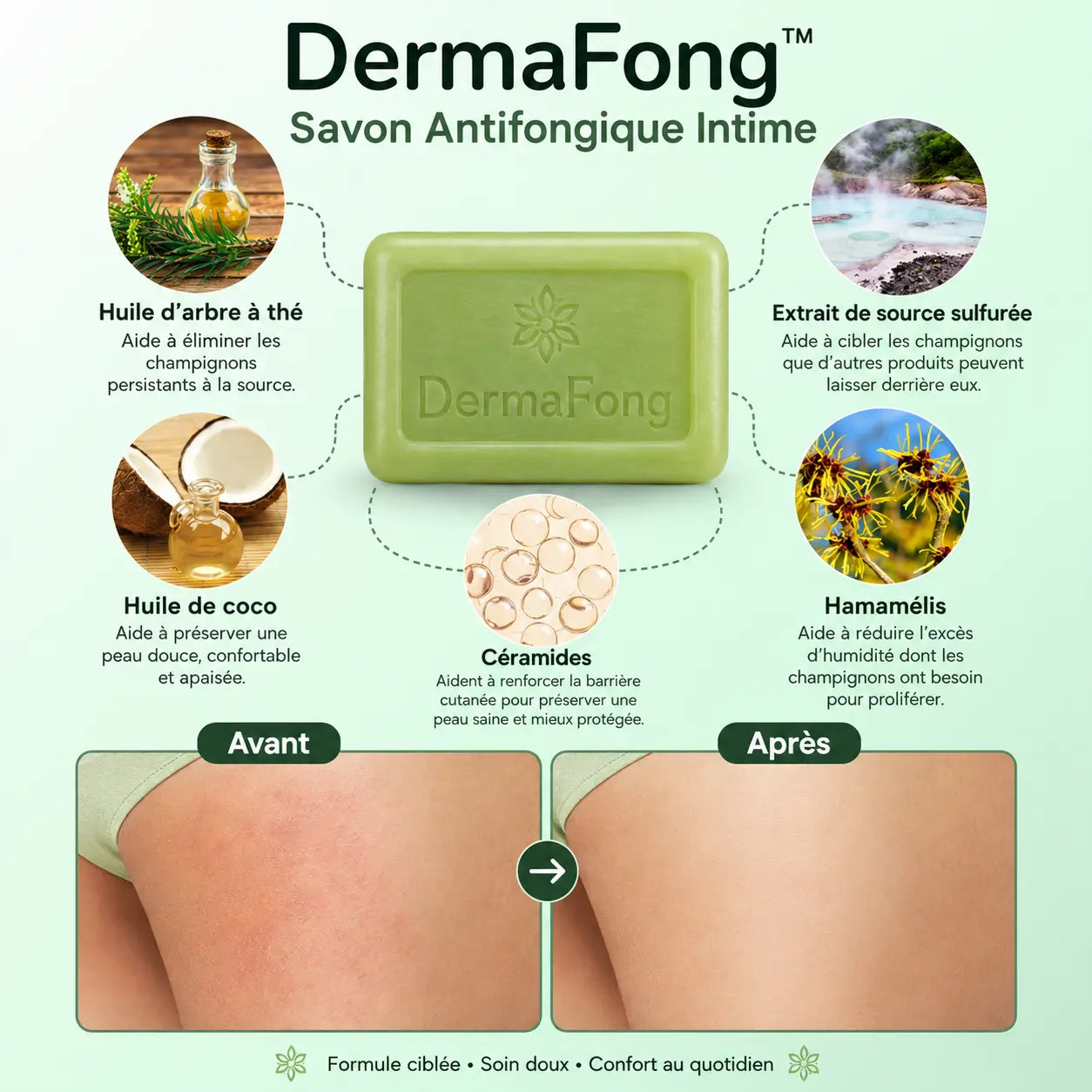 DermaFong™ Savon Antifongique Intime | Éliminez champignons, irritations et démangeaisons gênantes sans crème collante !