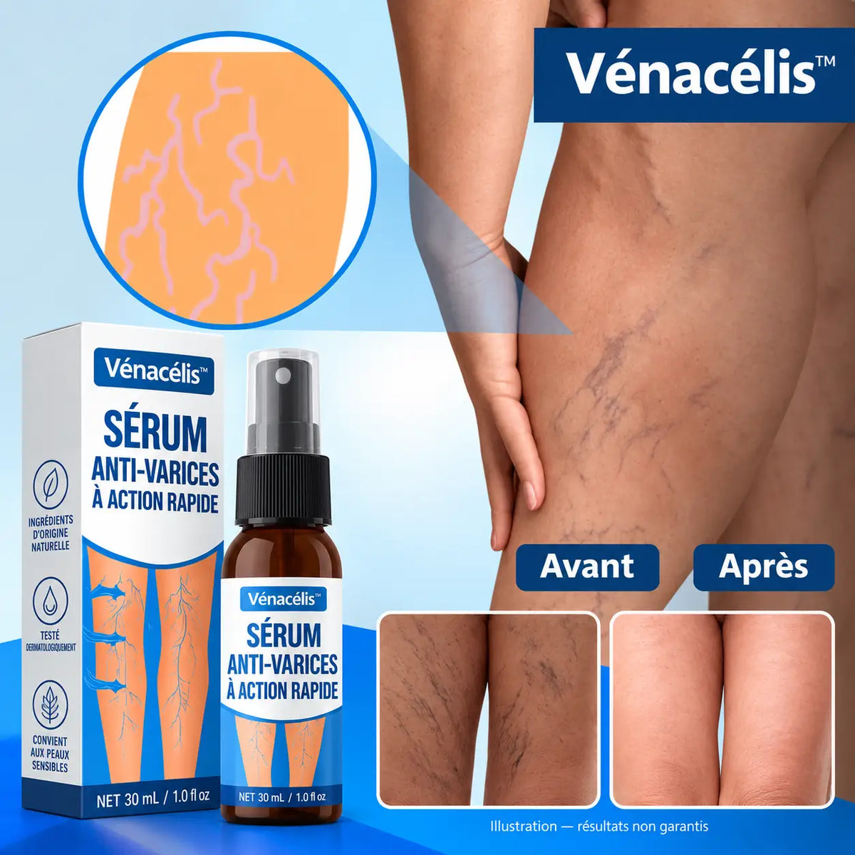 Vénacélis™ Sérum Anti-Varices à Action Rapide | Élimine 95% des varices visibles en 4 jours!