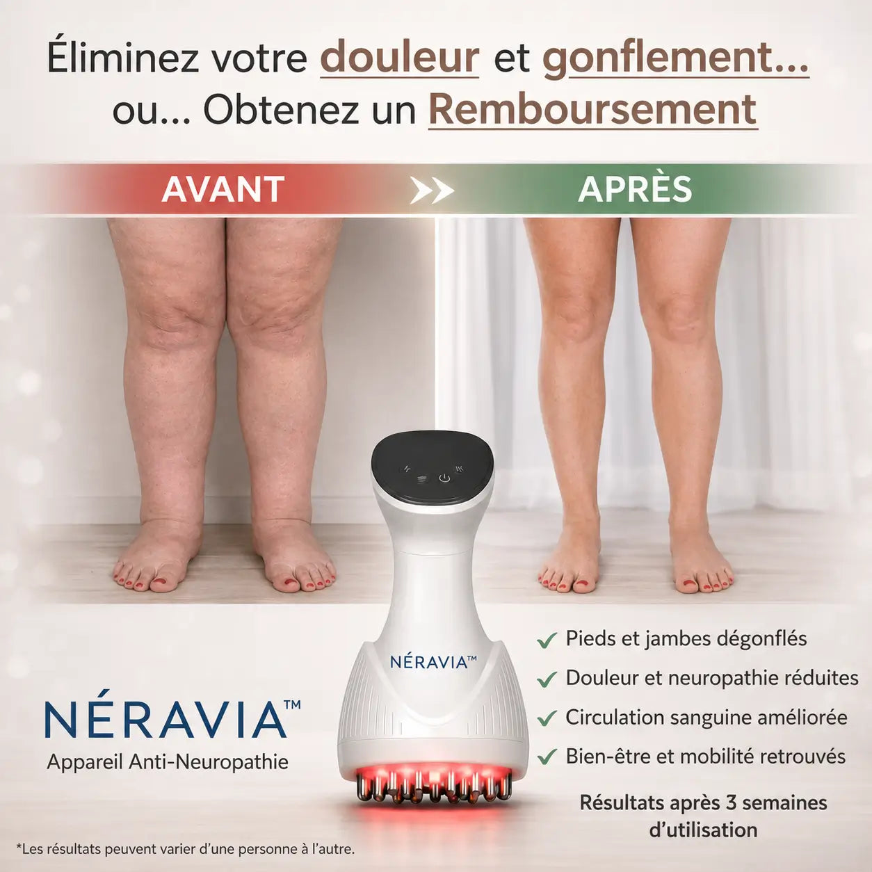 Néravia™ Appareil Anti-Neuropathie | Éliminez brûlures et picotements en 3 minutes !