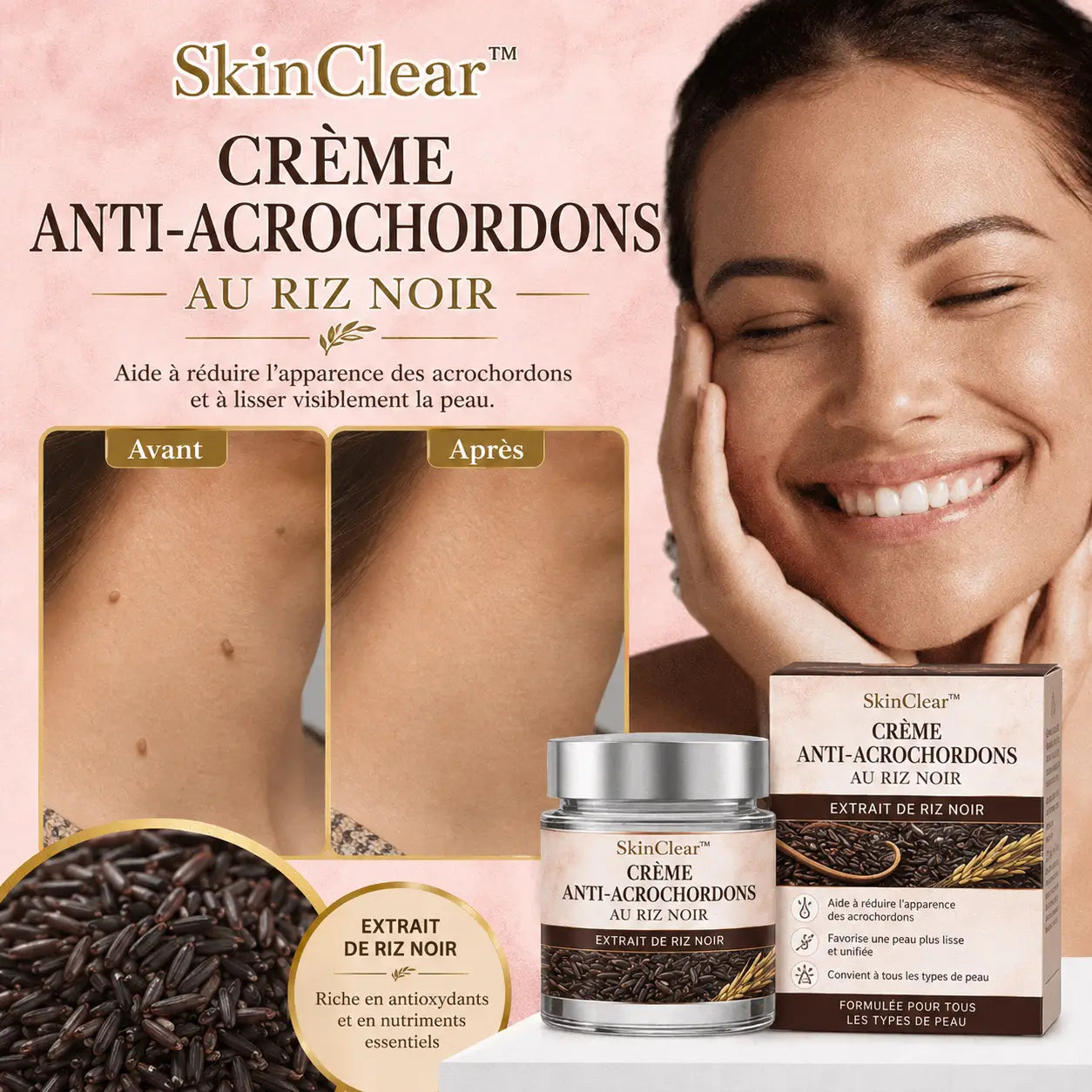 SkinClear™ Crème Anti-Acrochordons au Riz Noir | Faites disparaître les excroissances de peau sans brûlure ni cicatrice !
