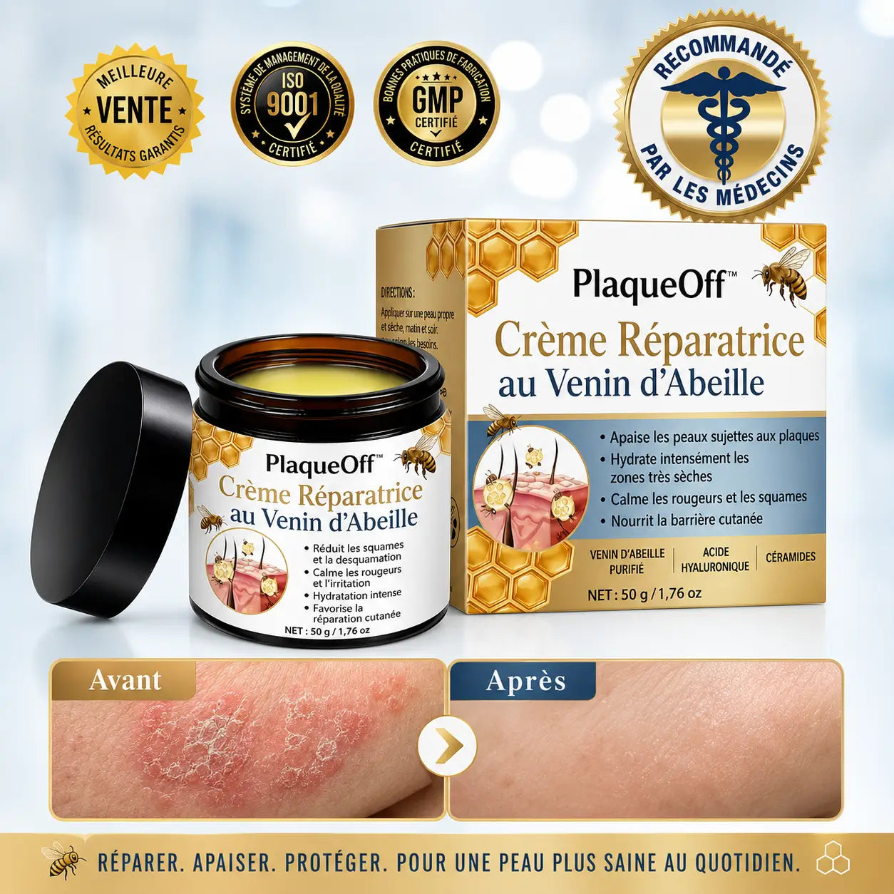 PlaqueOff™ Crème Réparatrice au Venin d’Abeille | Apaisez les plaques, rougeurs et démangeaisons en 60 secondes !