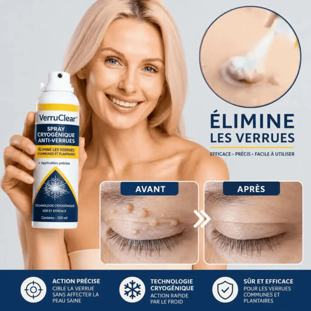 VerruClear™ Spray Cryogénique Anti-Verrues | Élimine les verrues tenaces et adoucit la peau en 7 jours !
