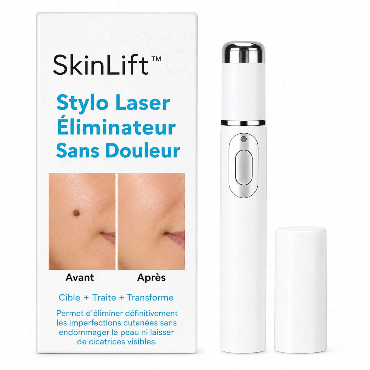 SkinLift™ Stylo Laser Éliminateur Sans Douleur | Efface les verrues et grains de beauté dès la 1ère utilisation!