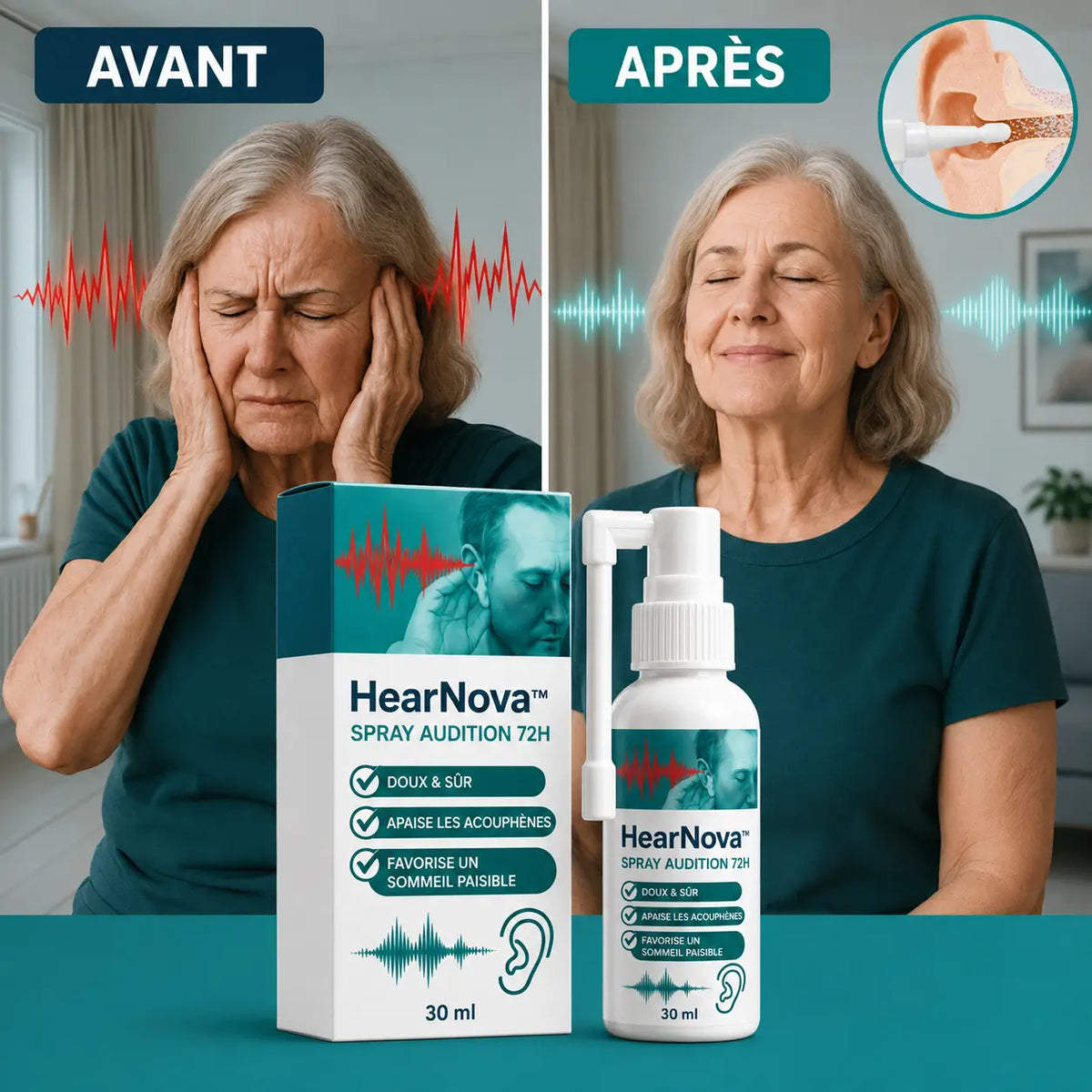 HearNova™ Spray Audition 72H | Améliorez votre audition jusqu'à 99 % en seulement 72 heures !