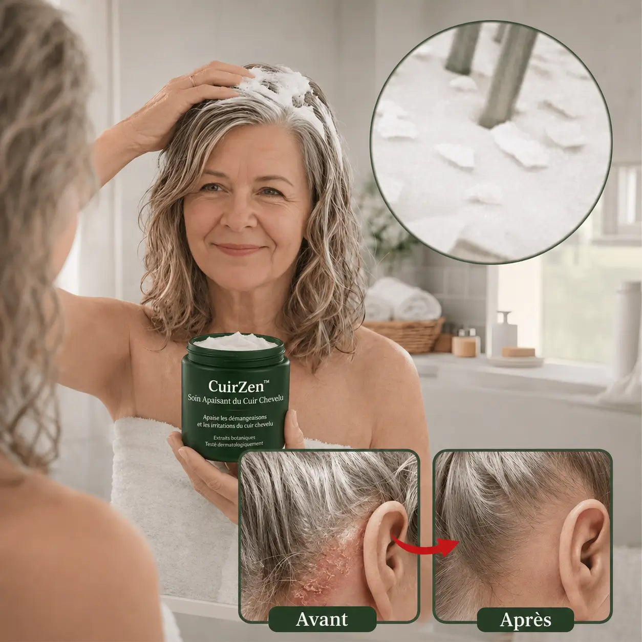 CuirZen™ Soin Apaisant du Cuir Chevelu | Apaise le cuir chevelu et élimine le psoriasis du cuir chevelu !