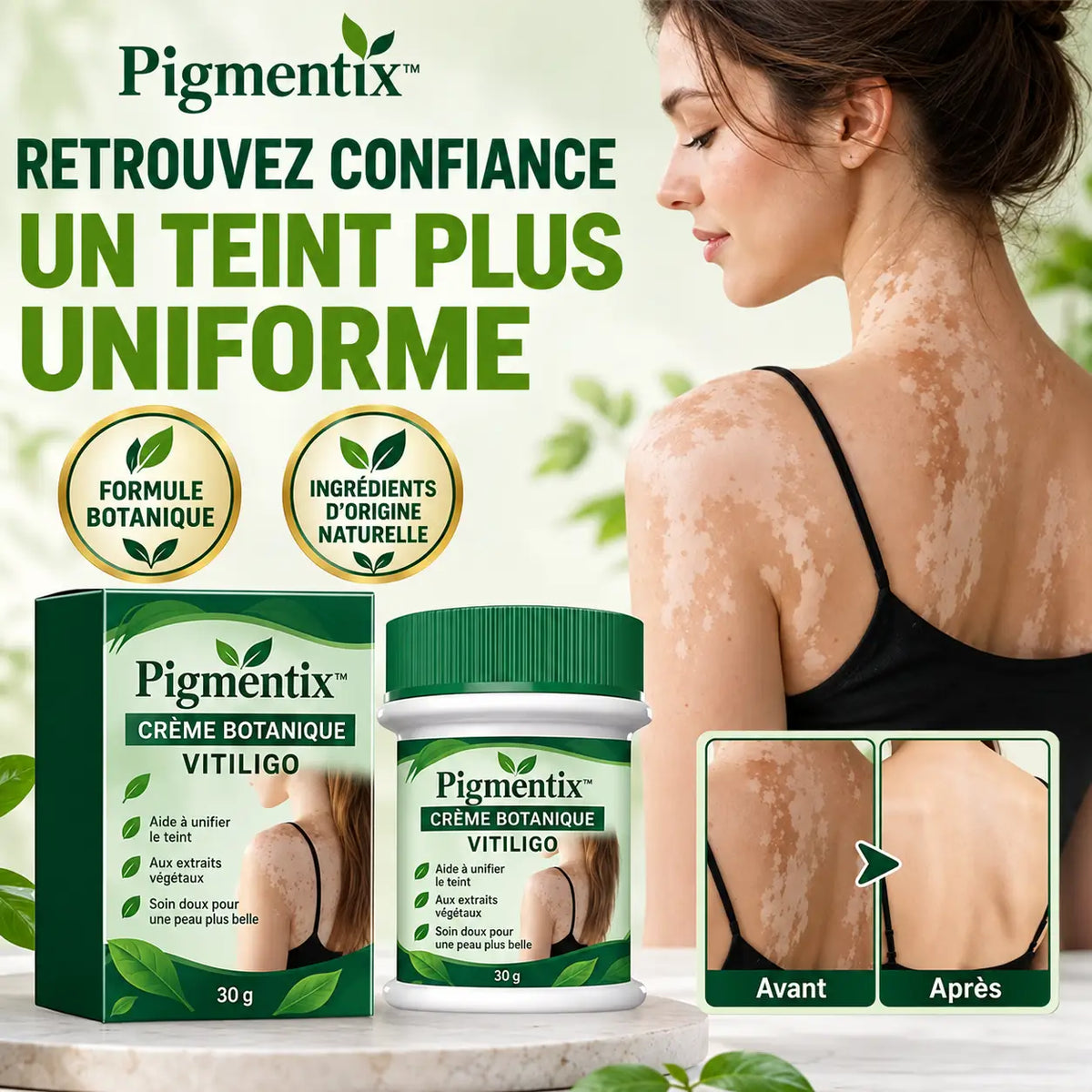 Pigmentix™ Crème Botanique Vitiligo | Réduisez l’apparence des taches blanches et retrouvez un teint plus uniforme sans maquillage épais !