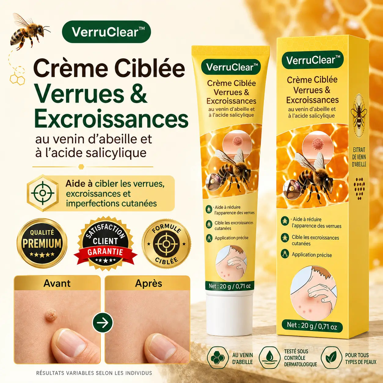 VerruClear™ Crème Ciblée Verrues & Excroissances | Lisse la peau en quelques jours et aide à faire disparaître les zones visibles !