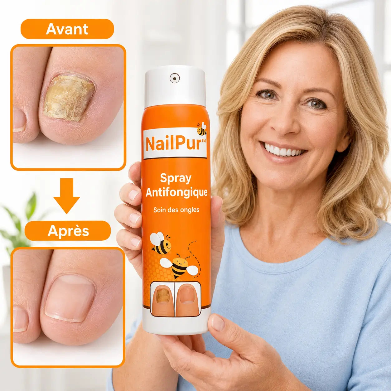 NailPur™ Spray Antifongique | Éliminez 99 % des mycoses des ongles en seulement 7 jours !