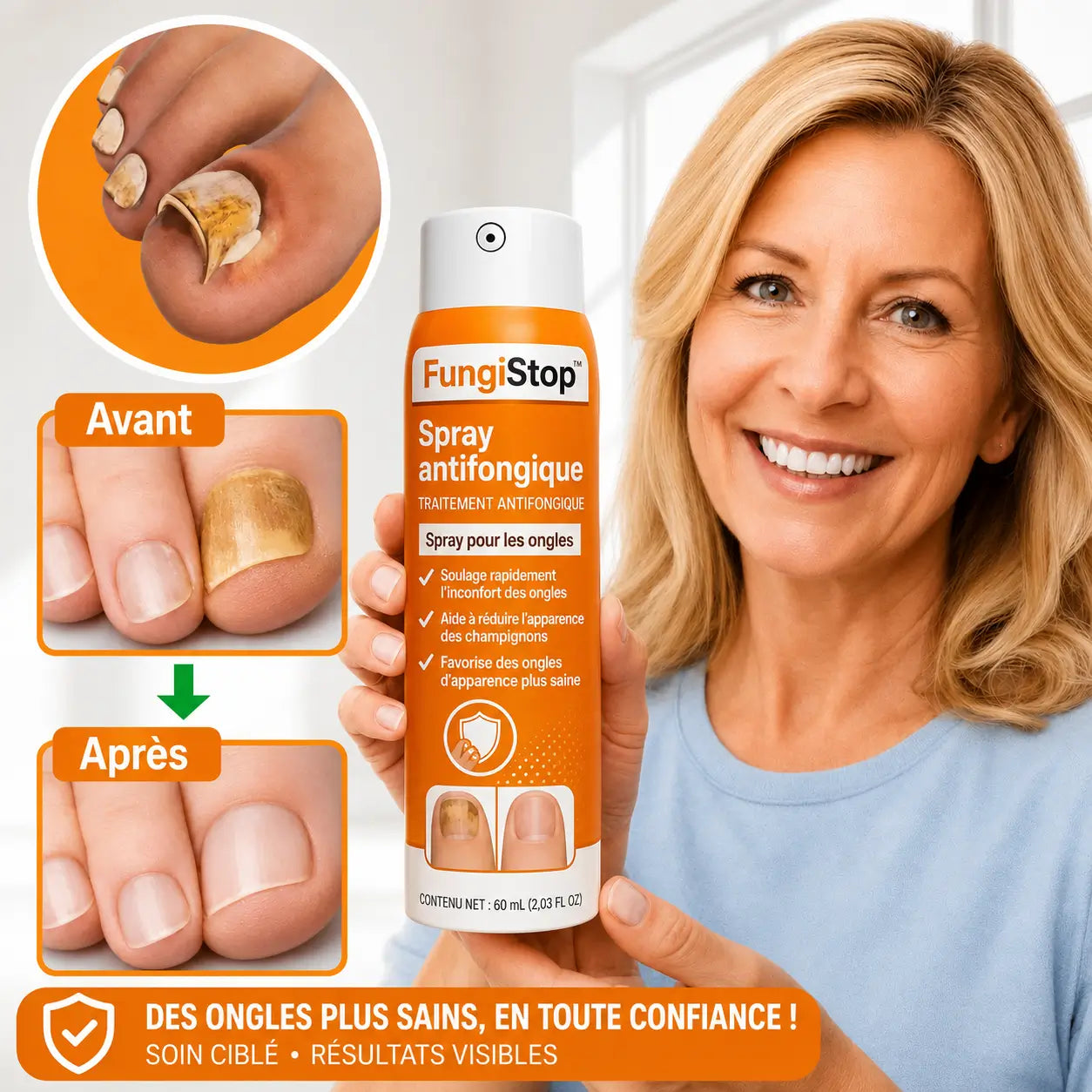 FungiStop™ Spray antifongique | Éliminez 99 % des mycoses des ongles en seulement 3 jours !