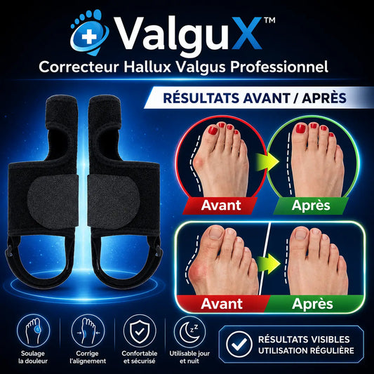 ValguX™ Correcteur Hallux Valgus Professionnel | Redressez vos orteils déformés en seulement 7 jours !