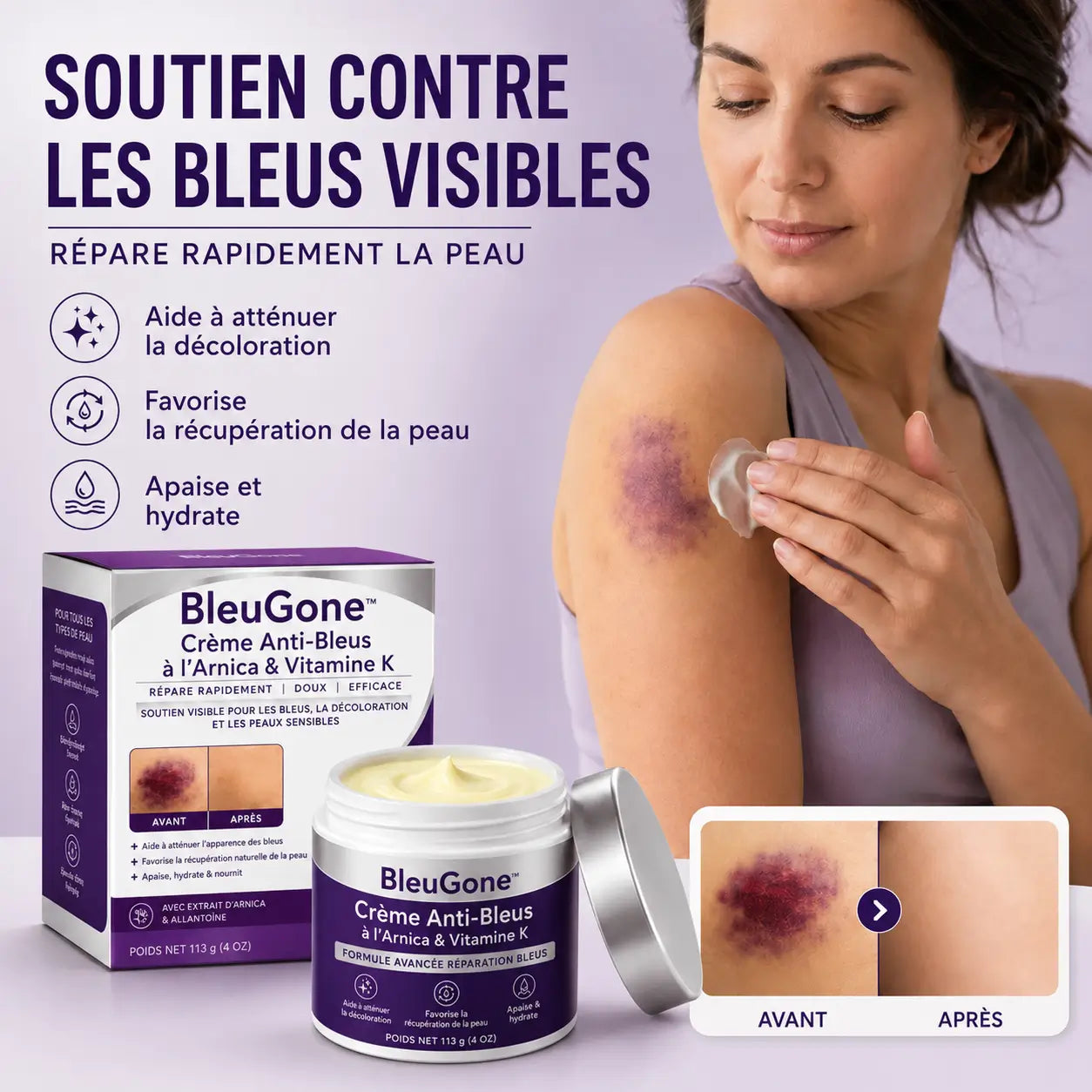 BleuGone™ Crème Anti-Bleus à l’Arnica & Vitamine K | Faites disparaître l’apparence des bleus, marques et taches sans crème grasse !