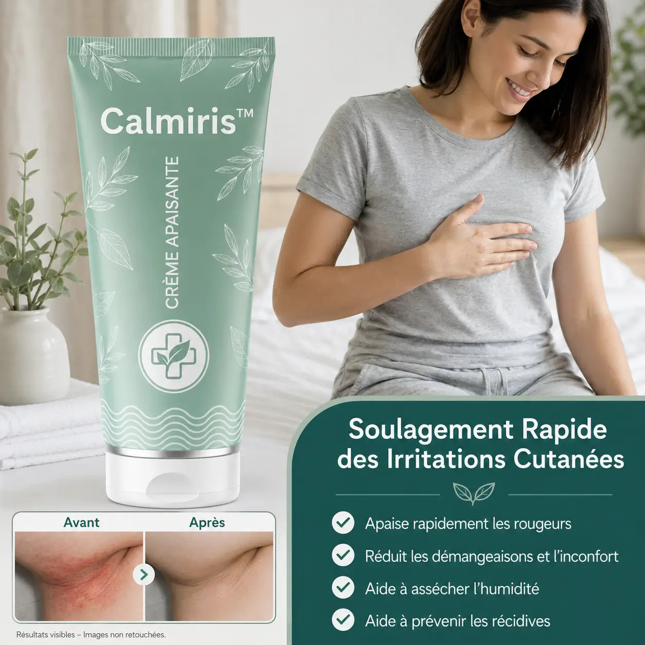 Calmiris™ Crème apaisante | Traite 99 % des irritations des plis cutanés dès la première application !