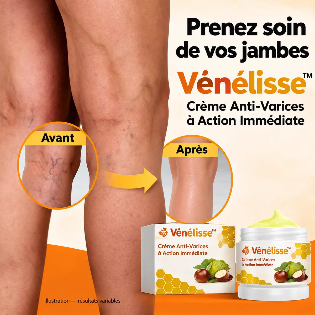 Vénélisse™ Crème Anti-Varices à Action Immédiate | Faites disparaître vos varices en 3 minutes !