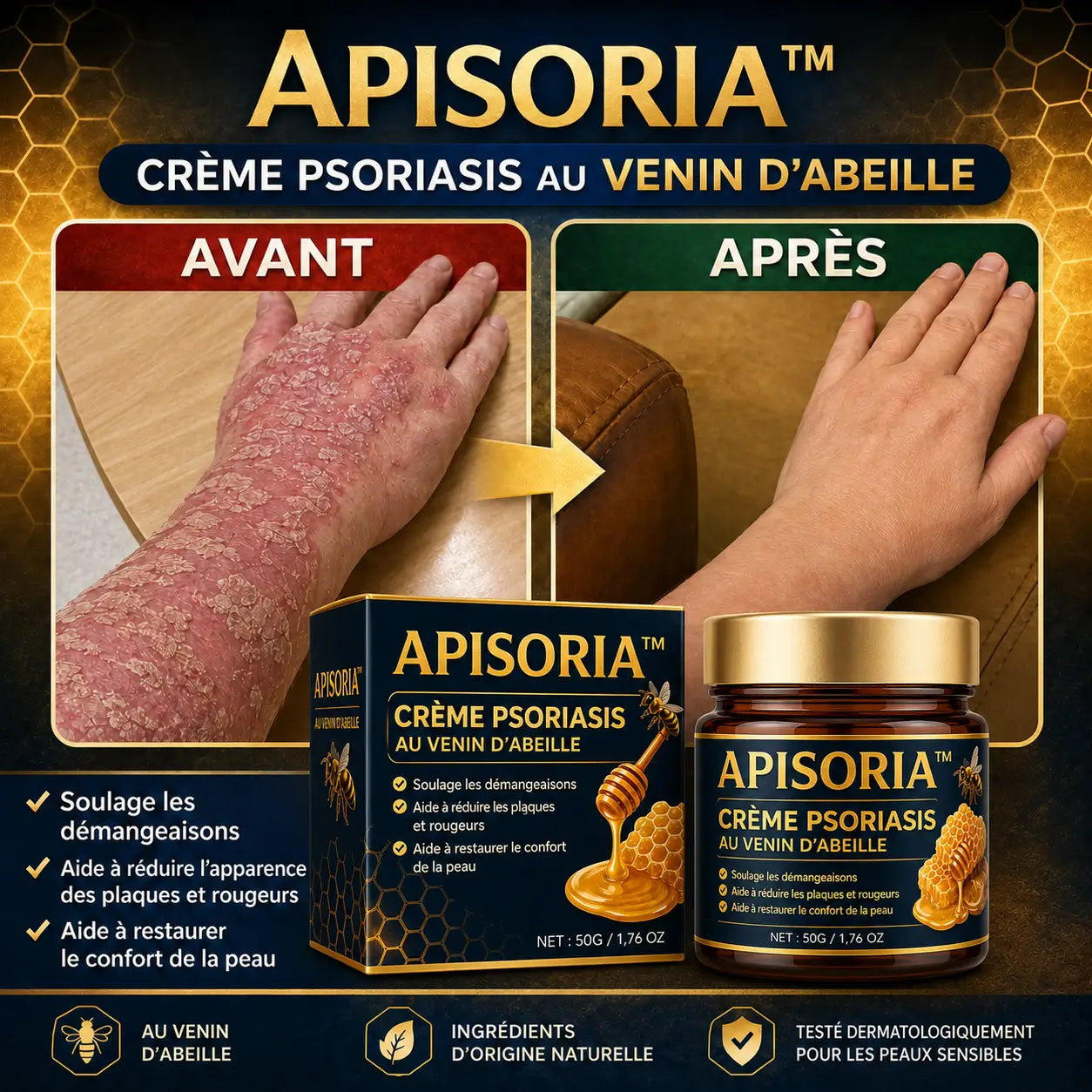 Apisoria™ Crème Psoriasis au Venin d’Abeille | Éliminez plaques, démangeaisons et rougeurs en quelques minutes !