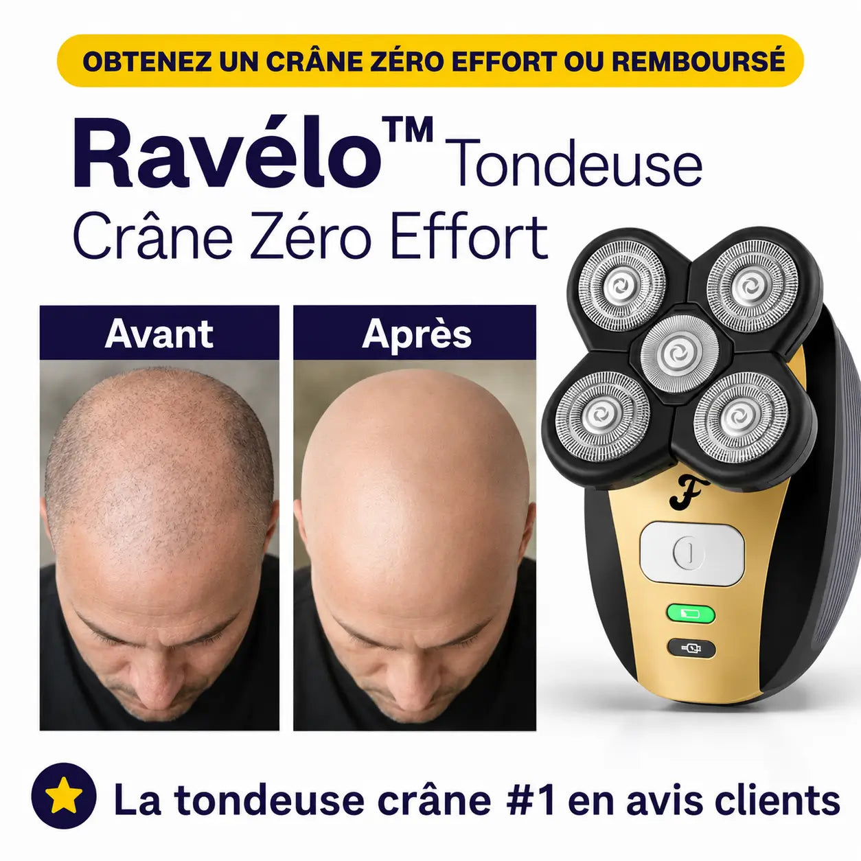 Ravélo™ Tondeuse Crâne Zéro Effort | Retrouvez une tête parfaitement rasée en 3 minutes !