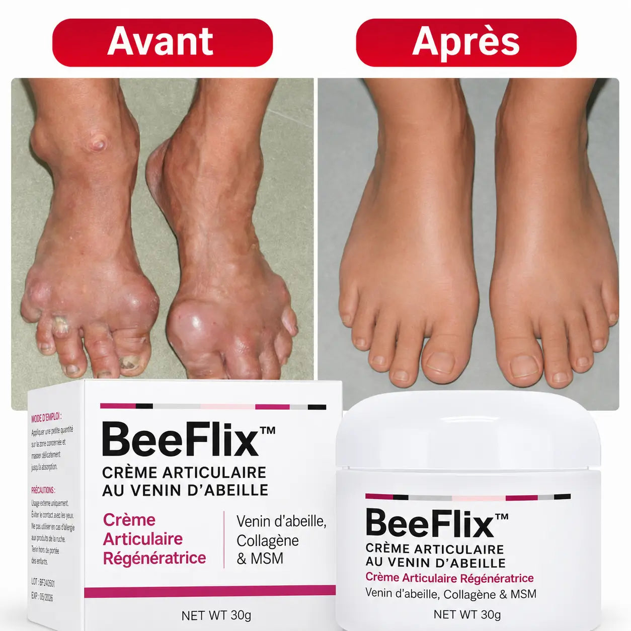 BeeFlix™ Crème Articulaire au Venin d’Abeille | Stoppez vos douleurs et retrouvez des mouvements plus fluides rapidement !