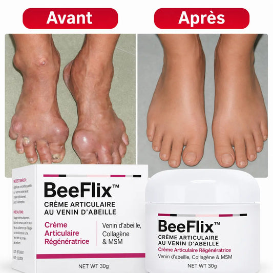 BeeFlix™ Crème Articulaire au Venin d’Abeille | Stoppez vos douleurs et retrouvez des mouvements plus fluides rapidement !