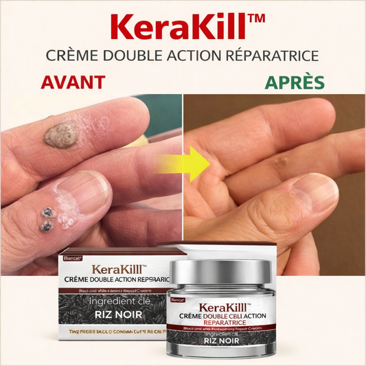 KeraKill™ Crème Réparatrice | Détruisez rugosités et imperfections en seulement quelques minutes !