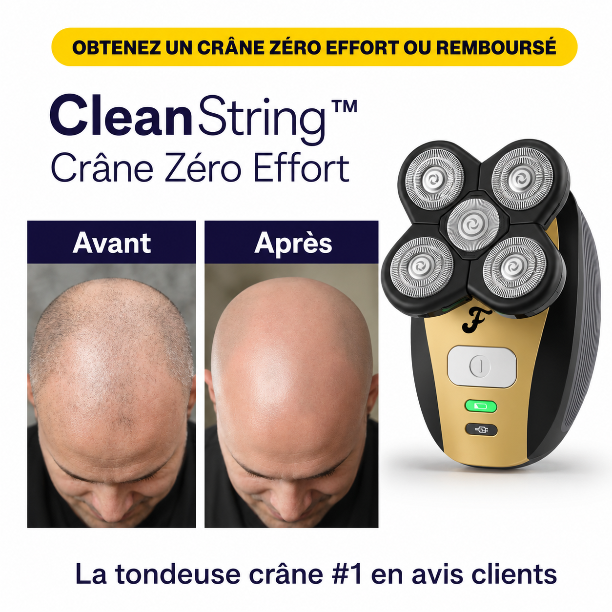 CleanString™ Tondeuse Crâne Zéro Effort | Retrouvez une tête parfaitement rasée en 3 minutes !