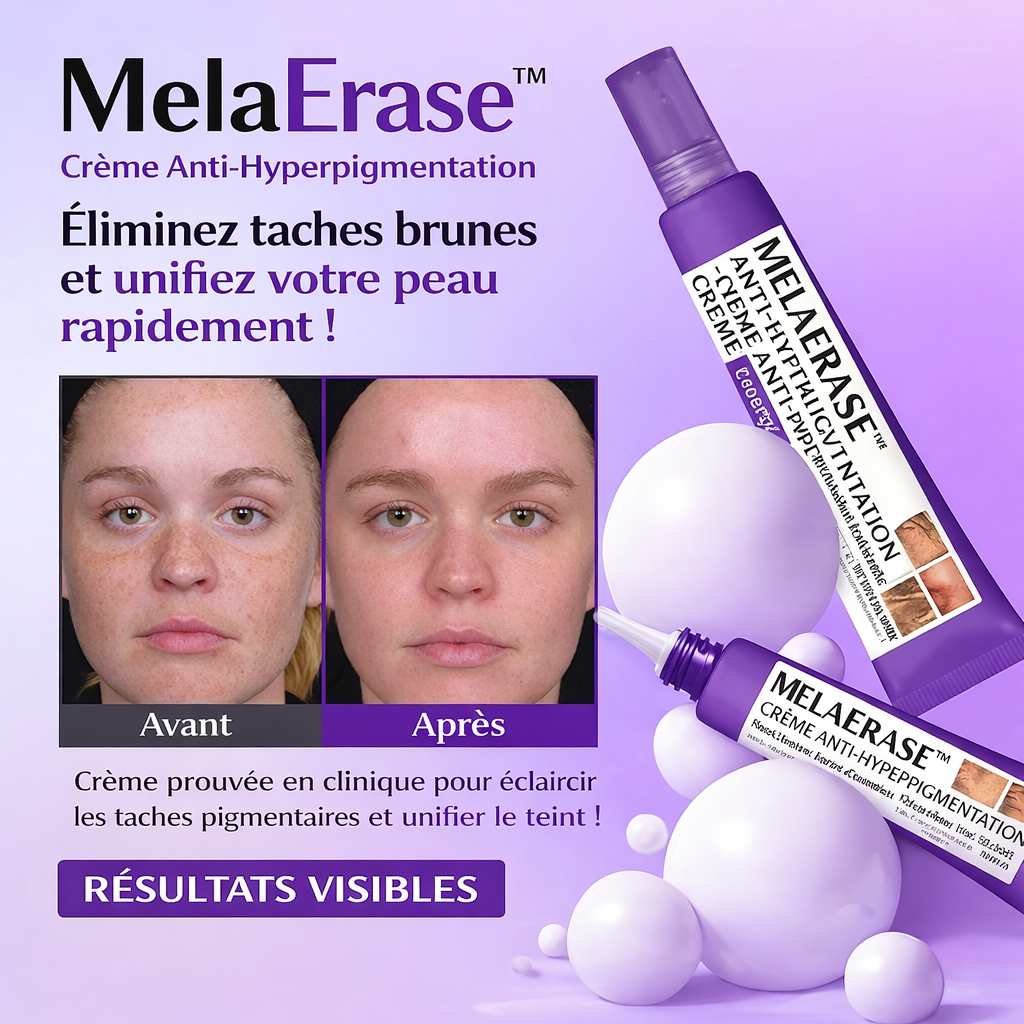 MelaErase™ Crème Anti-Hyperpigmentation | Éliminez taches brunes et unifiez votre peau rapidement !