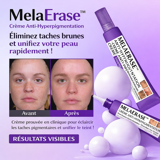 MelaErase™ Crème Anti-Hyperpigmentation | Éliminez taches brunes et unifiez votre peau rapidement !