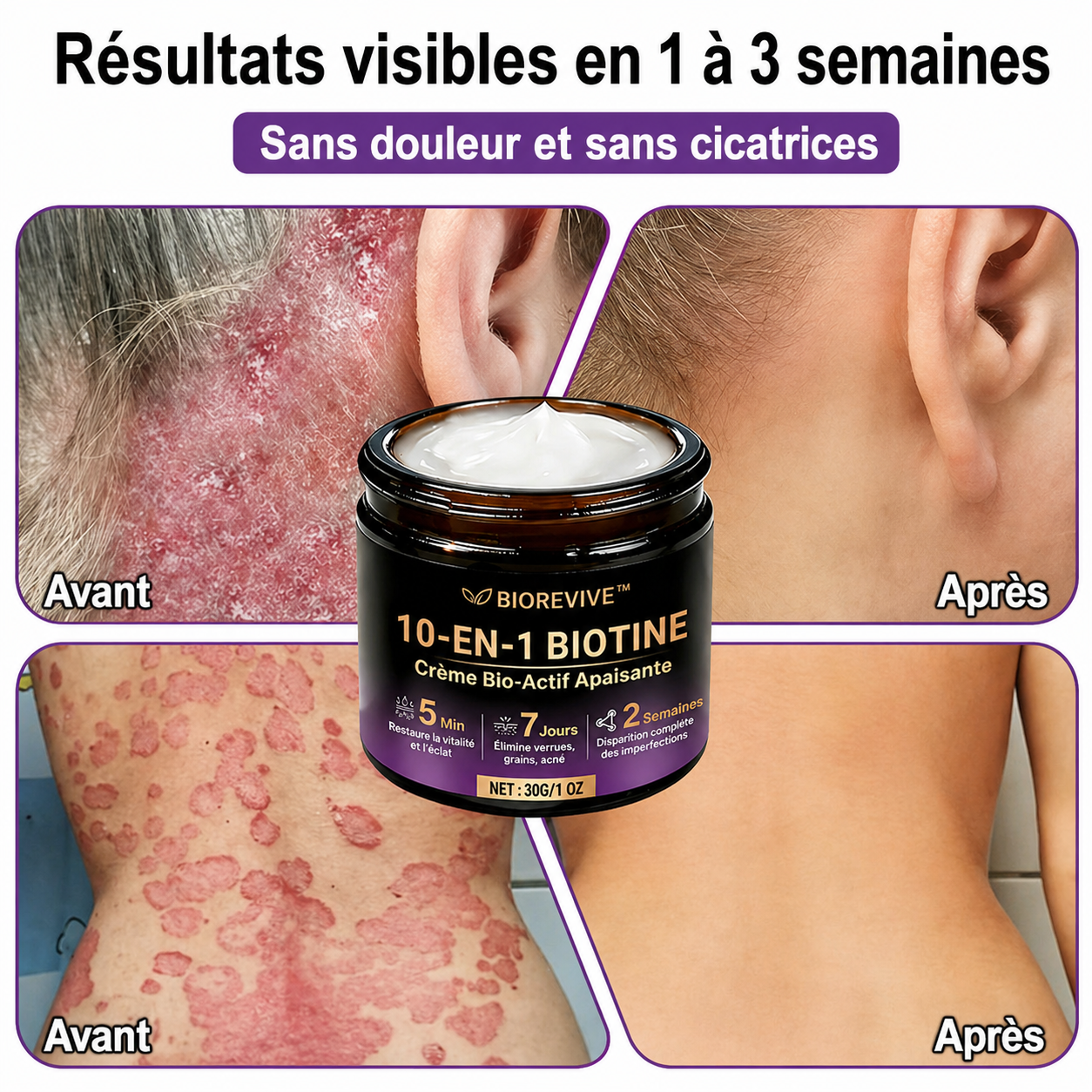 BioRevive™ Crème Bio-Actif Apaisante | Stoppe les démangeaisons et répare votre peau dès la première application !