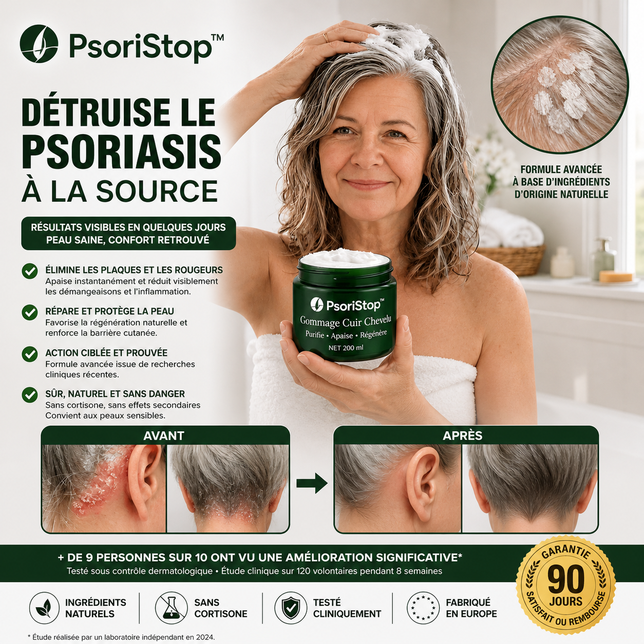 PsoriStop™ Crème Psoriasis Cuir Chevelu | Stoppez les démangeaisons et éliminez les plaques dès la 1ère utilisation !