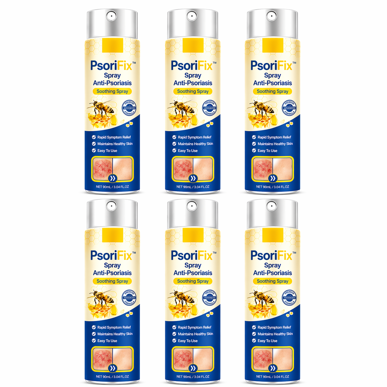 PsoriFix™ Spray Anti-Psoriasis | Réduit jusqu’à 95 % des plaques et démangeaisons en quelques semaines !