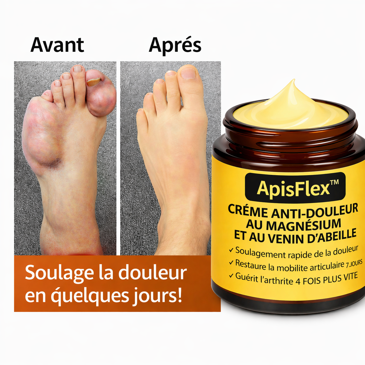 ApisFlex™ Crème Anti-Douleur au Venin d’Abeille | Supprimez vos douleurs articulaires en quelques minutes
