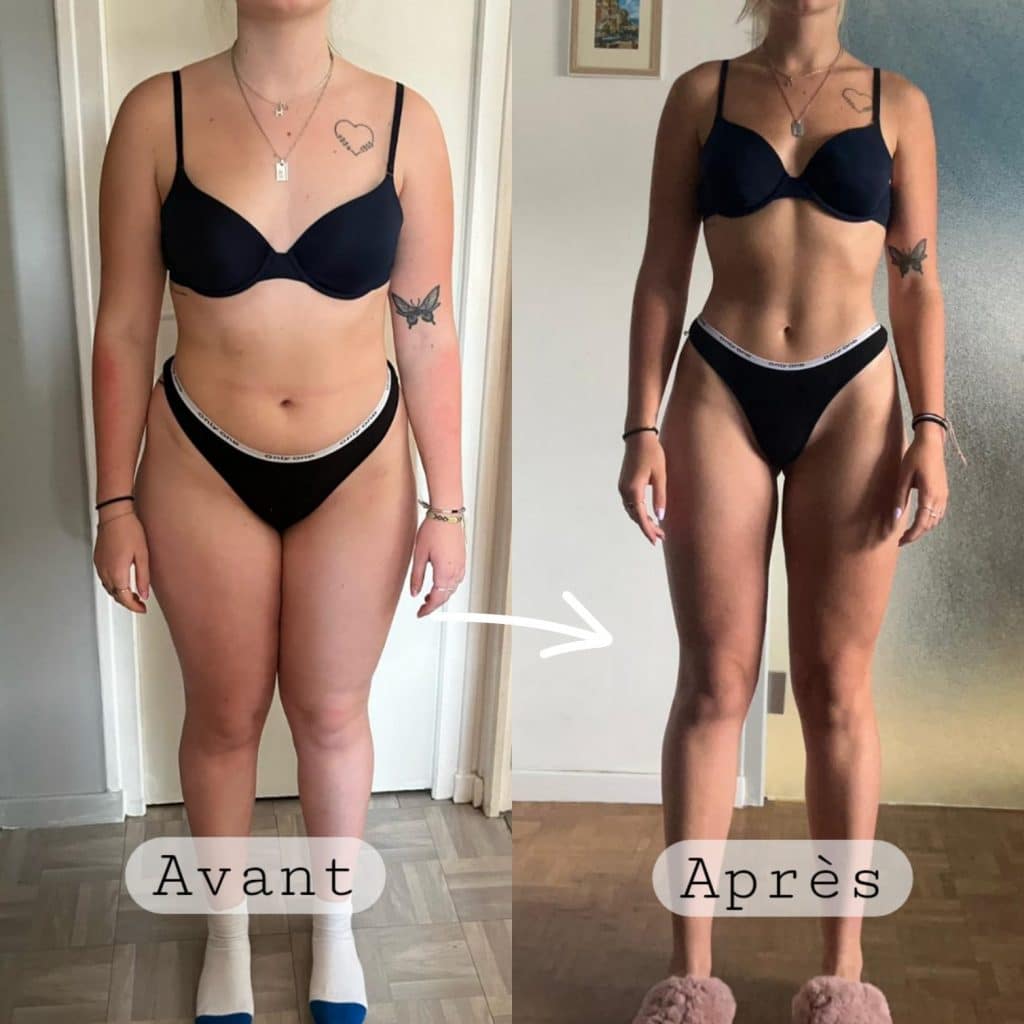 LipoPulse™ Ultrasonic Slimming Bracelet image LipoPulse™ Ultrasonic Slimming Bracelet