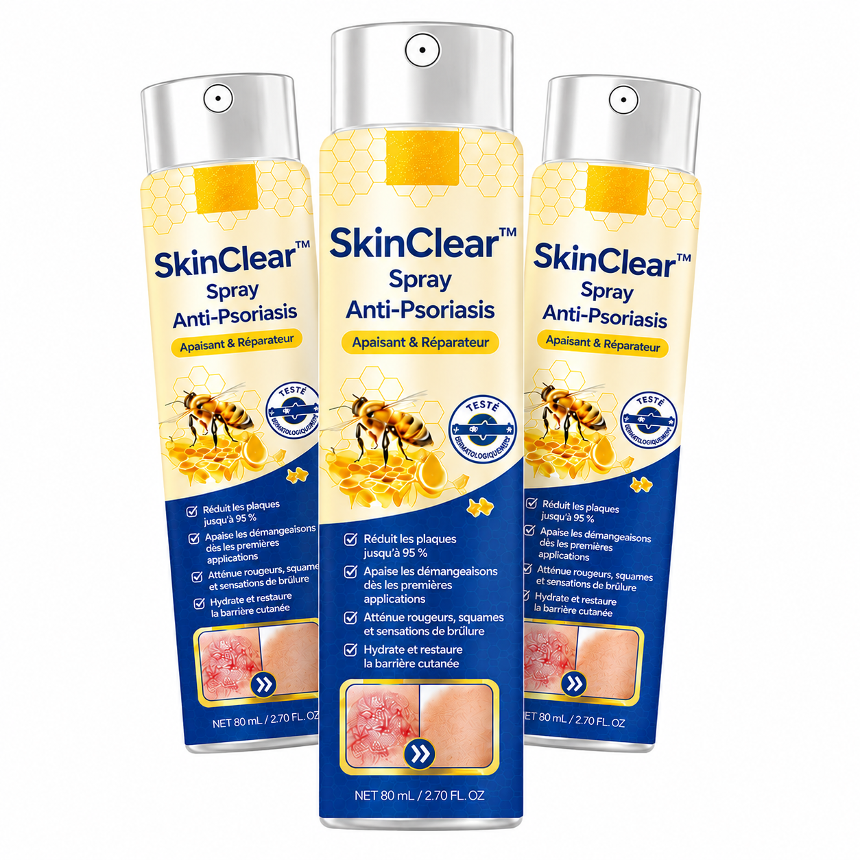 SkinClear™ Spray Anti-Psoriasis | Réduit jusqu’à 95 % des plaques et démangeaisons en quelques semaines !