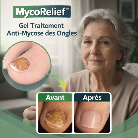 MycoRelief™ Gel Traitement Anti-Mycose des Ongles | Dites adieu aux mycoses des ongles en seulement 3 jours !