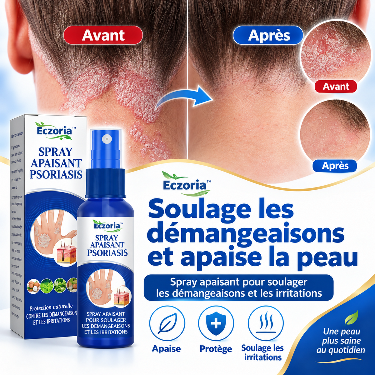 Eczoria™ Spray Apaisant Psoriasis | Apaisez les démangeaisons et retrouvez une peau plus confortable dès les premières applications !