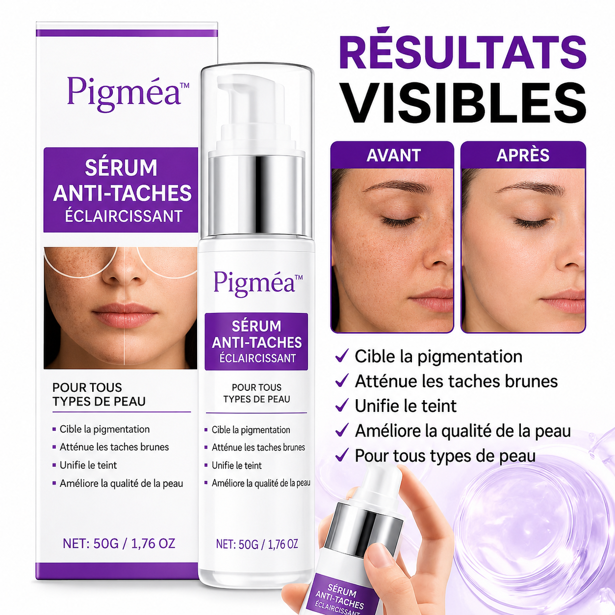 Pigméa™ Sérum Anti-Taches Éclaircissant | Effacez vos taches brunes en 72 heures chrono!