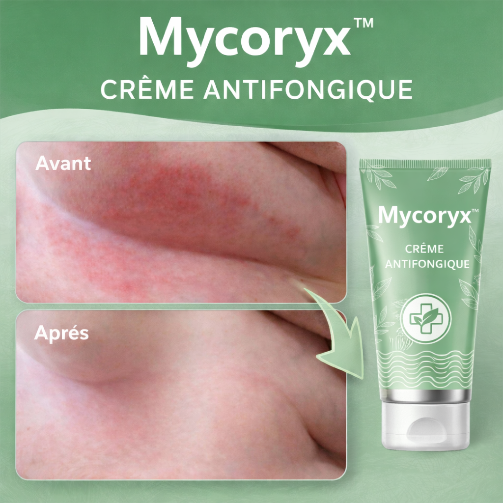 Mycoryx™ Crème Antifongique | Éliminez 99 % des mycoses cutanées en une semaine !