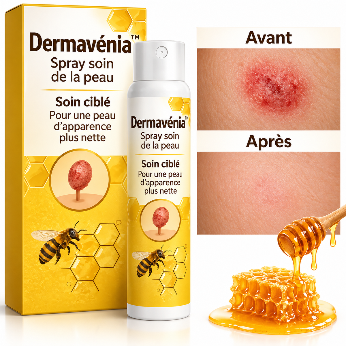 Dermavénia™ Spray Cutané au Venin d’Abeille | Éliminez verrues, taches et boutons en 10 minutes !